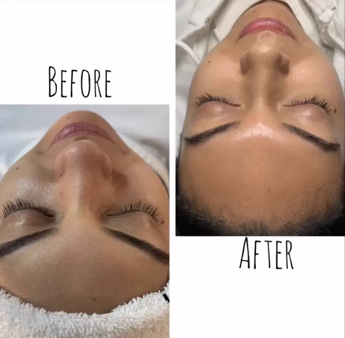 Dahlia Aesthetics LI, Inc Picture 6