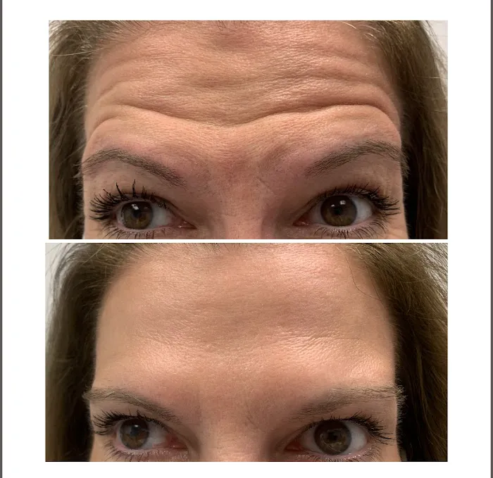 Hamptons Cosmetic Dermatology Picture 4