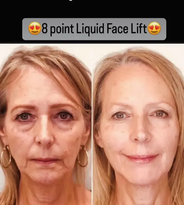 Hamptons Cosmetic Dermatology Picture 7