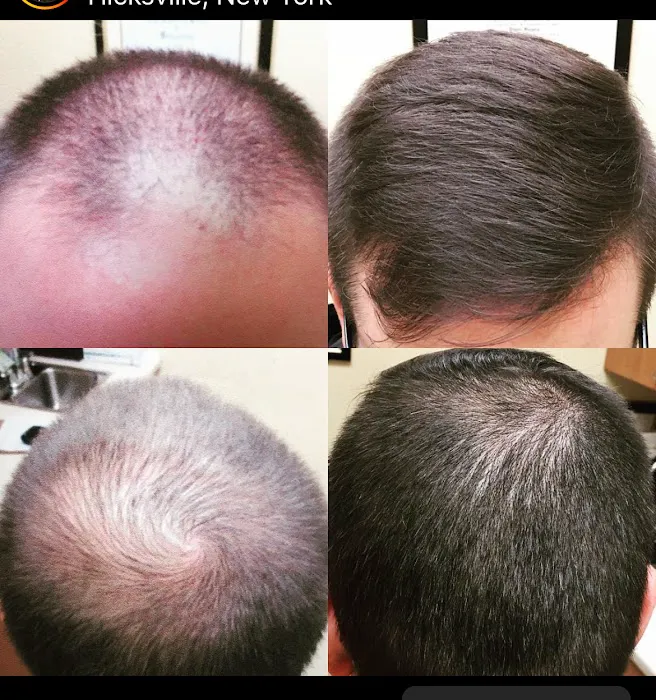 Hamptons Cosmetic Dermatology Picture 5