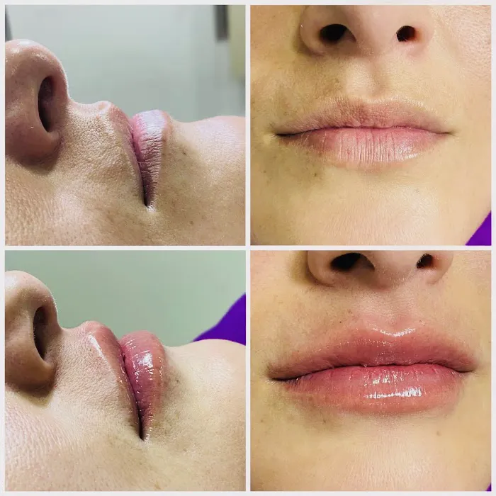 Hampton's Esthetic Center #1 Picture 5