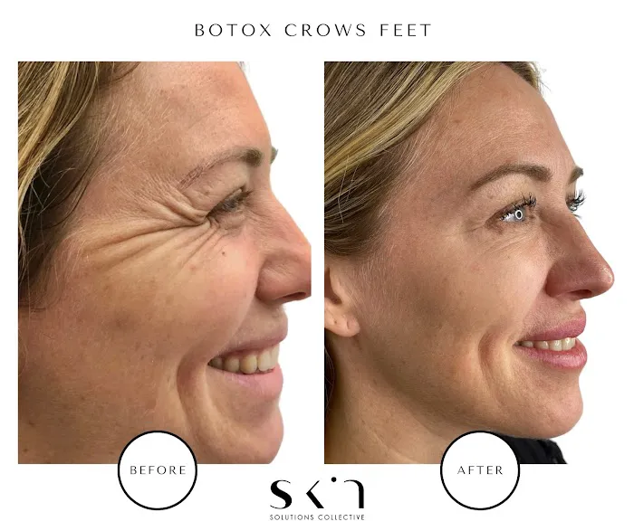 Skin Solutions Collective - Hamptons Picture 8