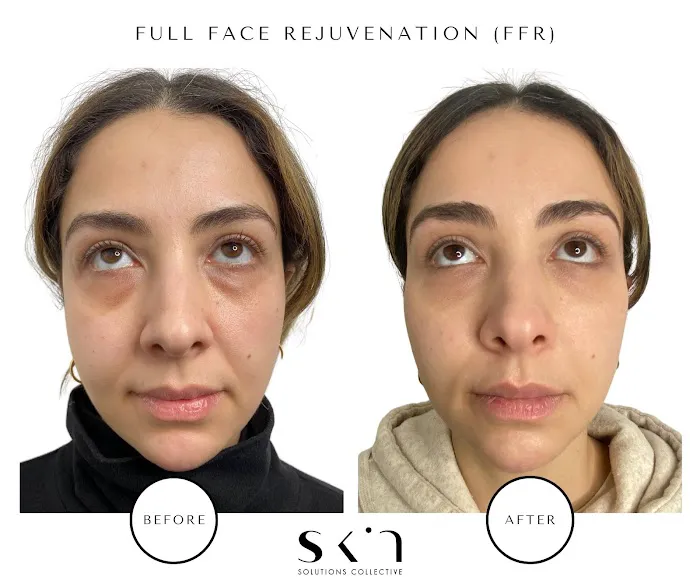 Skin Solutions Collective - Hamptons Picture 7