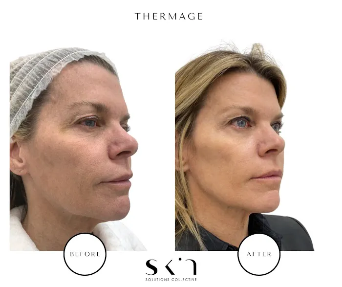 Skin Solutions Collective - Hamptons Picture 5