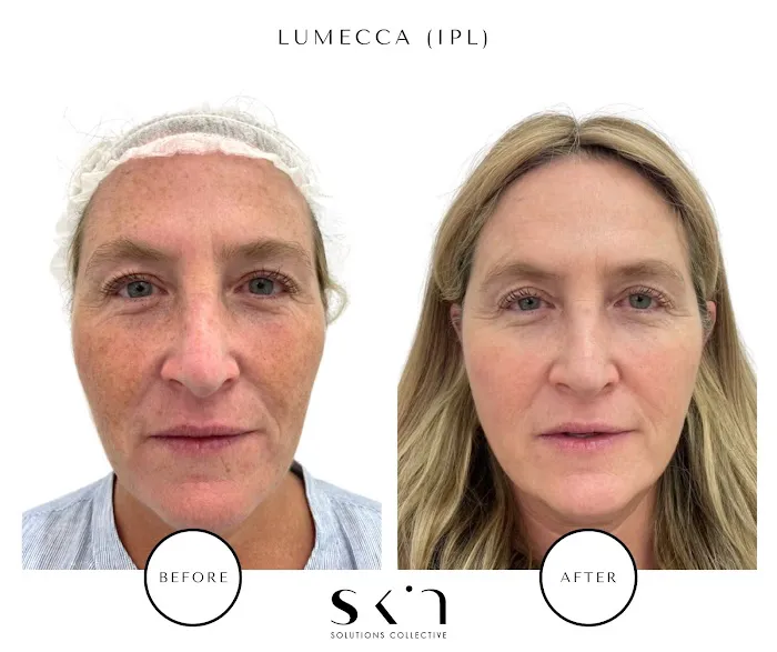 Skin Solutions Collective - Hamptons Picture 9