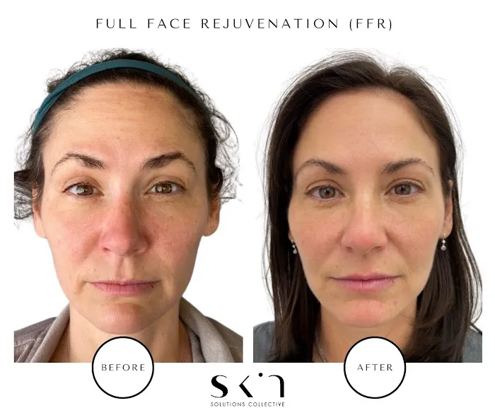 Skin Solutions Collective - Hamptons Picture 10