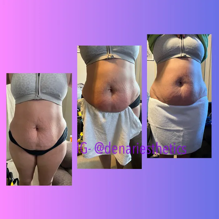 Denari Esthetics, LLC Picture 3