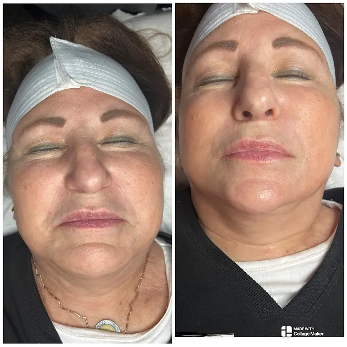 Denari Esthetics, LLC Picture 5