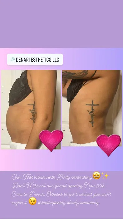 Denari Esthetics, LLC Picture 6