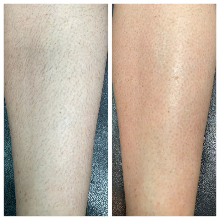 Esthetics by Amanda LLC Picture 9