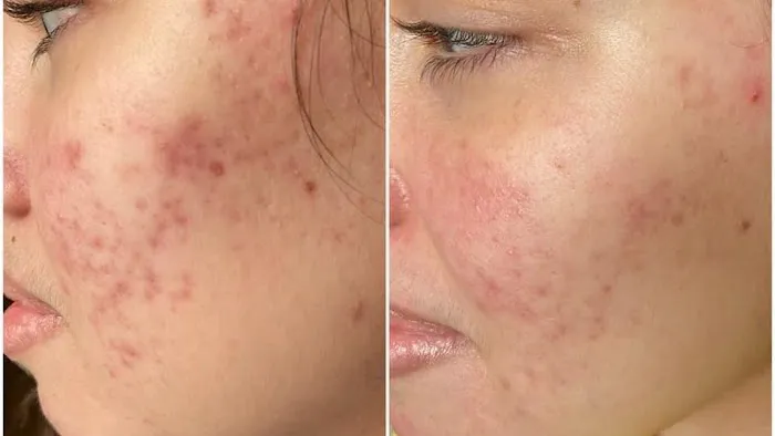 Skin with Lynn Picture 4