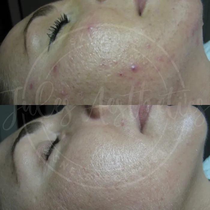 Jules Aesthetics Picture 3