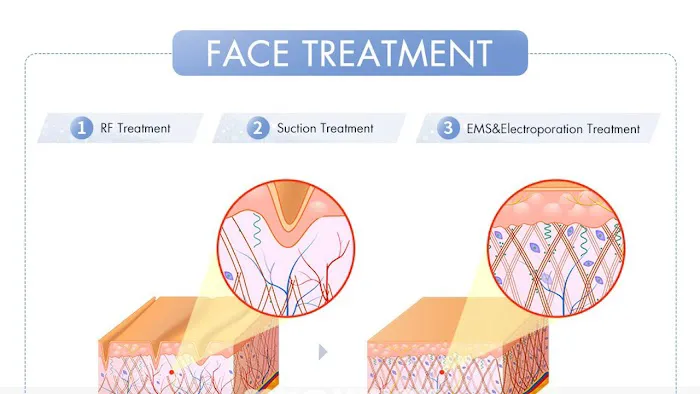 Skinplicity Picture 2