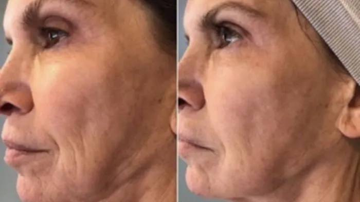 Skinplicity Picture 4