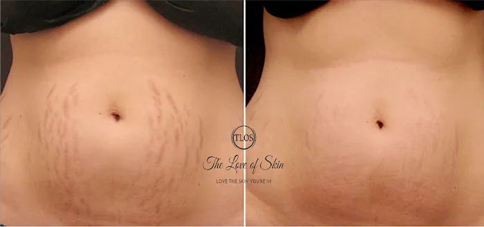 The Love of Skin Picture 6