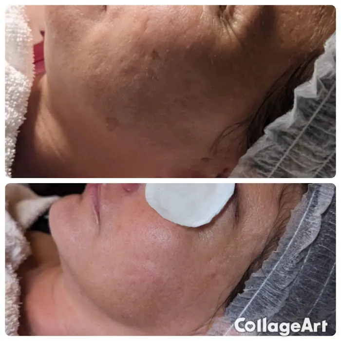 The Love of Skin Picture 7