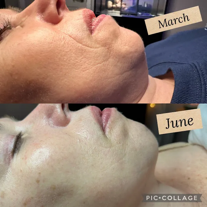 Katie Jean Esthetics Picture 5