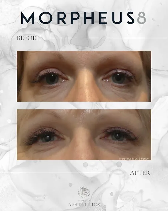 Greenville Aesthetics Picture 5