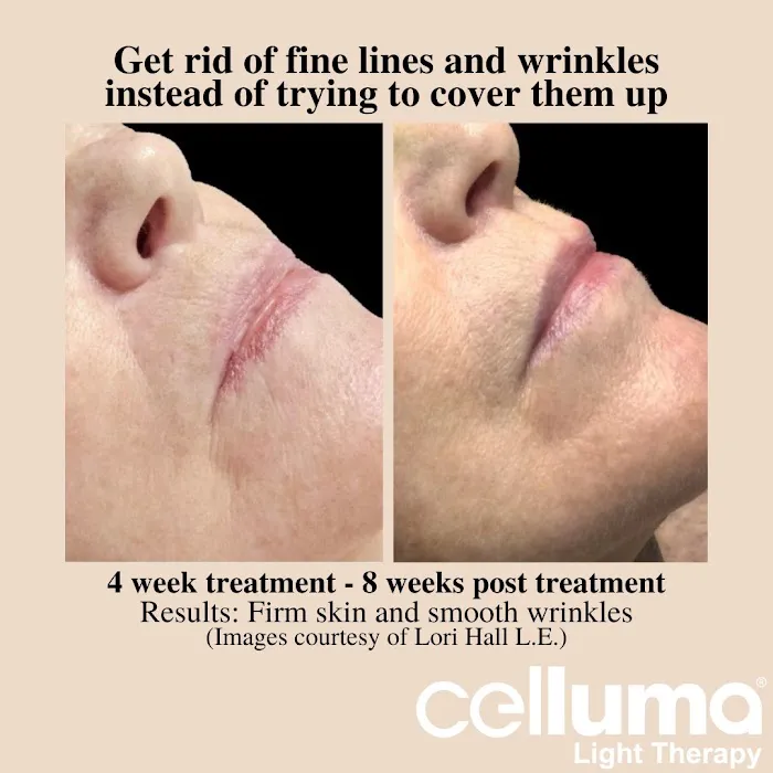 Radiance Esthetics Picture 9