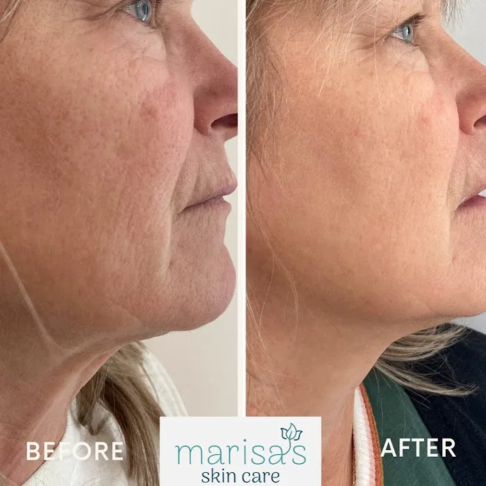 Marisa's Skin Care Picture 10