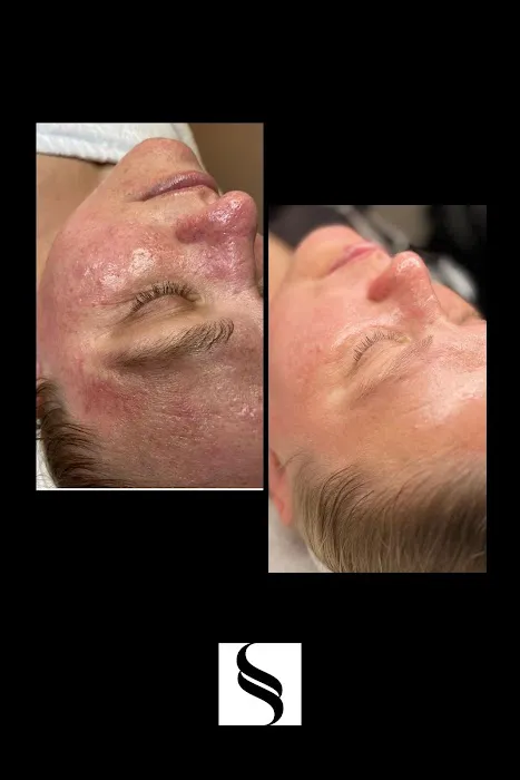 Skinspot Advanced Aesthetics Picture 6