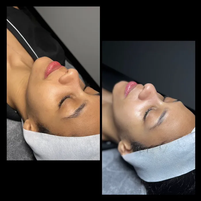 Skinspot Advanced Aesthetics Picture 4