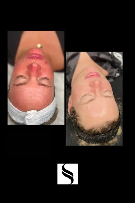 Skinspot Advanced Aesthetics Picture 7