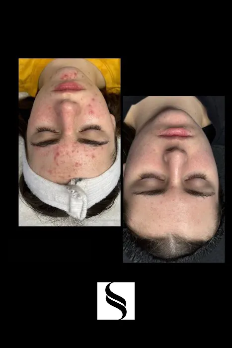 Skinspot Advanced Aesthetics Picture 8