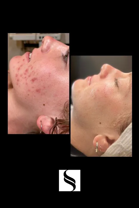 Skinspot Advanced Aesthetics Picture 9