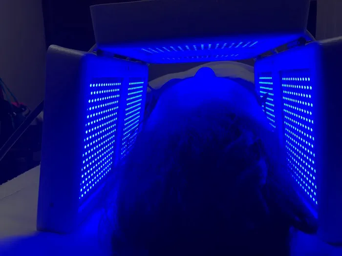 Lightwave Facials Picture 6