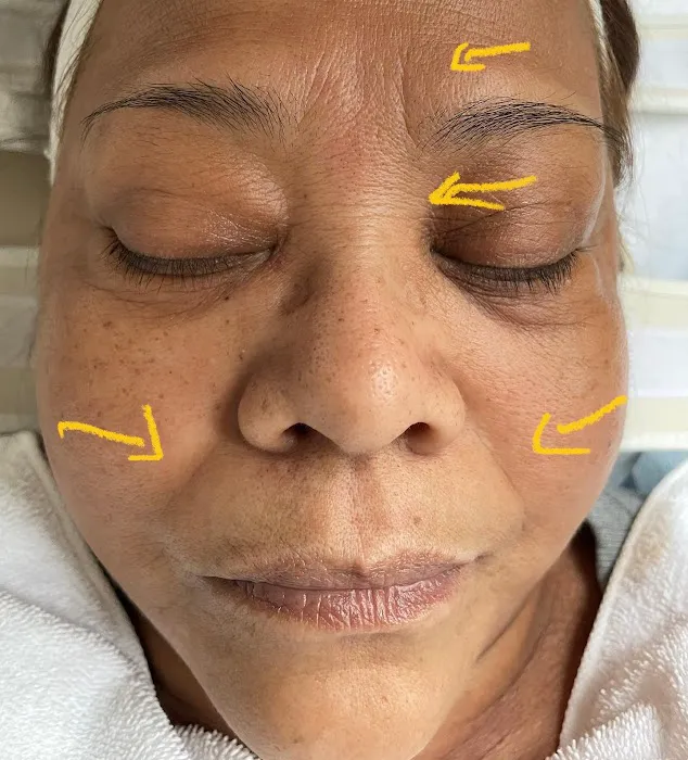 Unique Electrolysis & Skin Center Picture 8