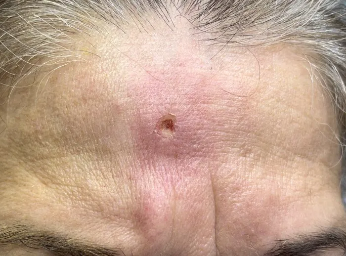 Unique Electrolysis & Skin Center Picture 10