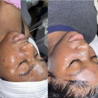 Q’kare beauty - Acne Specialist Auburn Massachusetts ico