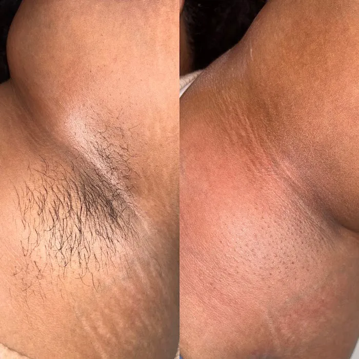 Q’kare beauty - Acne Specialist Auburn Massachusetts Picture 3