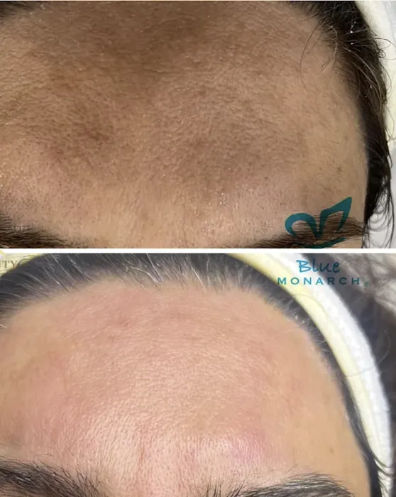 Blue Monarch Picture 10