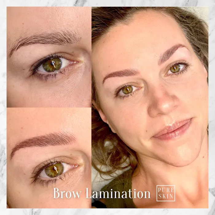 Pure Skin Permanent Cosmetics Picture 8