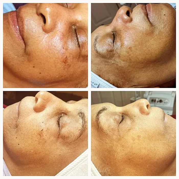 Butterflies in Paris esthetics Picture 3