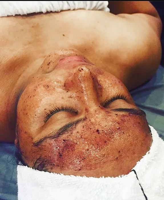 Skinspot Advanced Aesthetics Picture 2