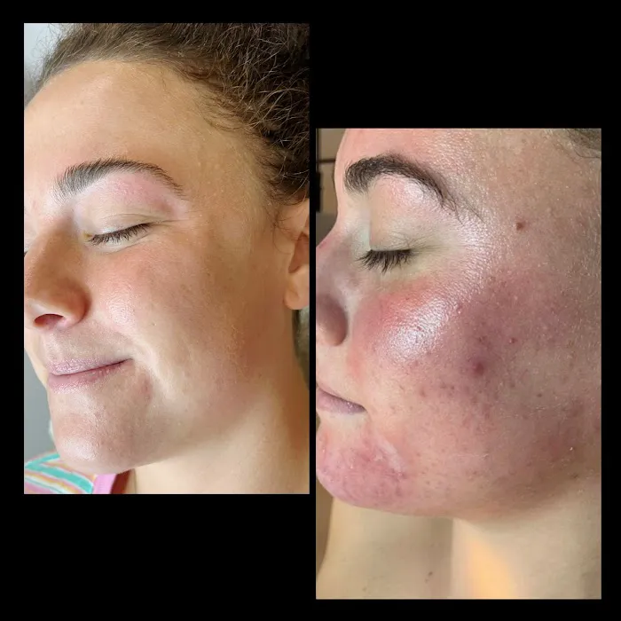 Skinspot Advanced Aesthetics Picture 8