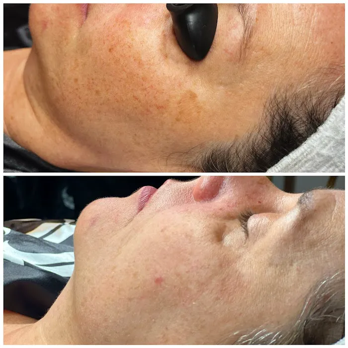 Skinspot Advanced Aesthetics Picture 10
