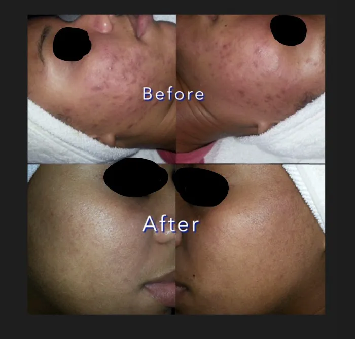Acne center Picture 4