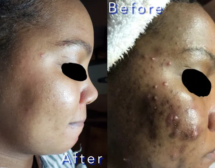 Acne center Picture 5