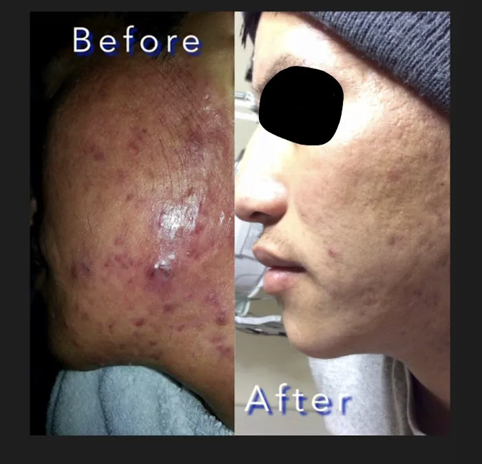 Acne center Picture 3