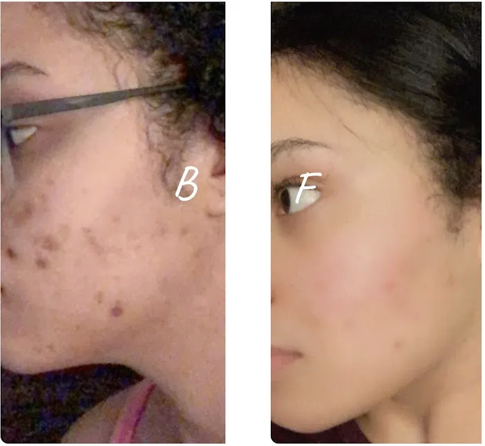 Acne center Picture 6