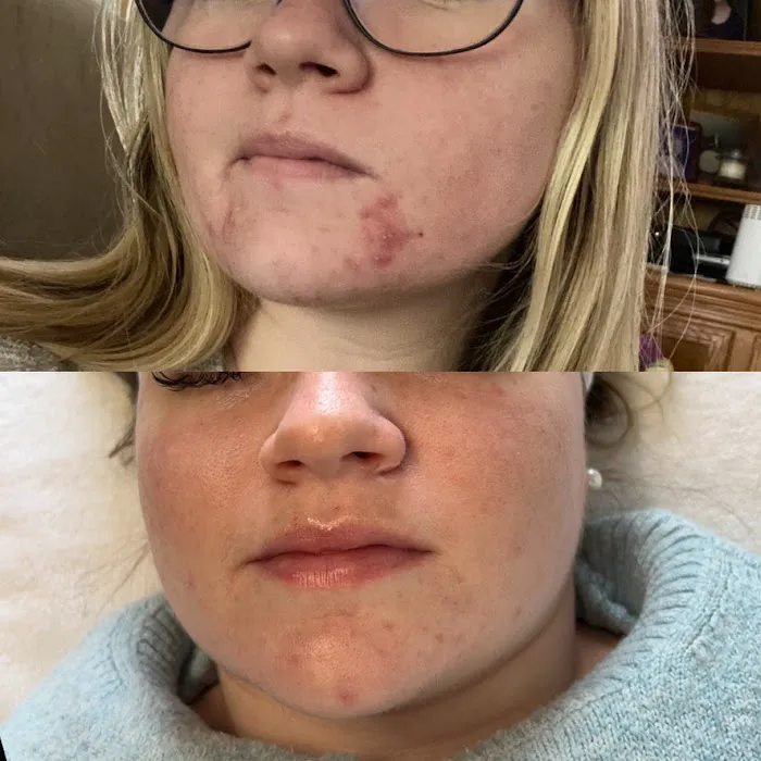 Skin By Summer Picture 2