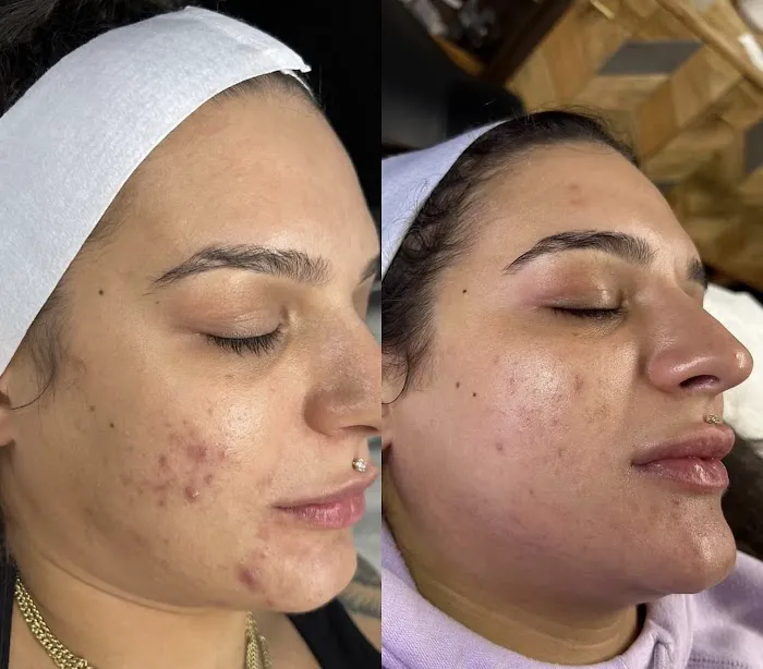 Skin By Summer Picture 5