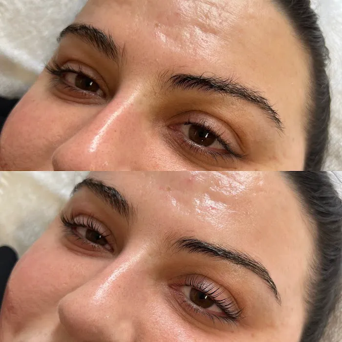 Skin By Summer Picture 8