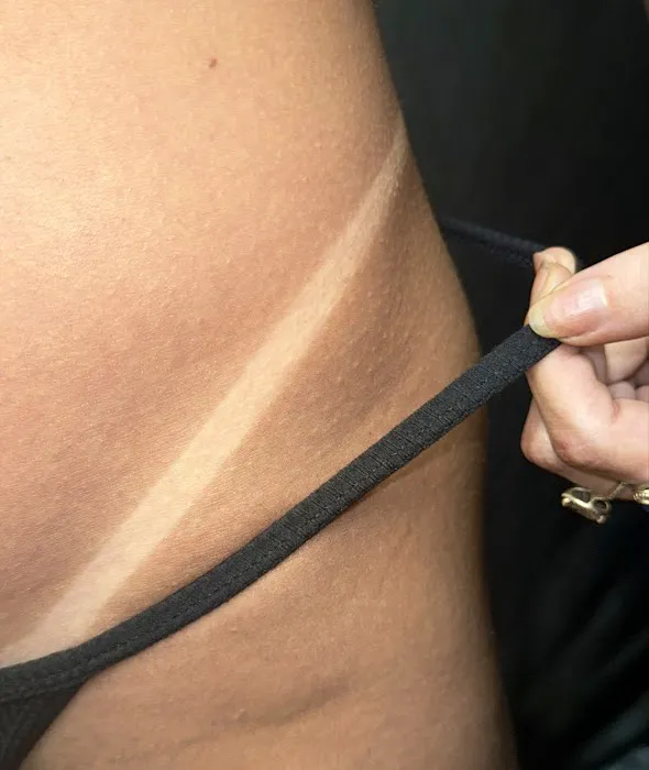 Skin By Summer Picture 7