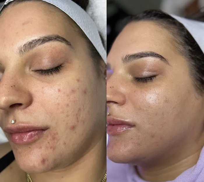 Skin By Summer Picture 9