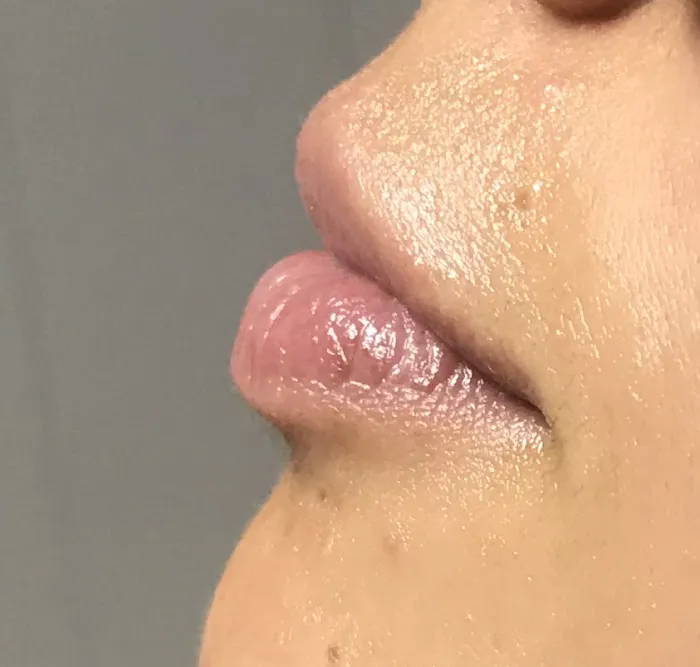 Esthetics Center New England Picture 4